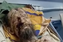 Rợn gáy lời kể “quý ông” như “xác ướp” bị gấu nhốt trong hang