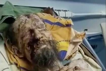 Rợn gáy lời kể “quý ông” như “xác ướp” bị gấu nhốt trong hang