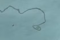 Thấy đau đầu, ghê rợn phát hiện con vật dài 12cm sống trong não