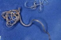 Rợn người chiêu thức kết liễu vật chủ của ký sinh trùng tàn ác