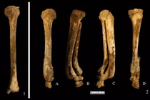 Bộ xương cổ đại tiết lộ hình phạt chặt chân phụ nữ Trung Quốc 3.000 năm trước 