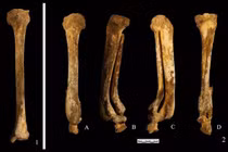 Bộ xương cổ đại tiết lộ hình phạt chặt chân phụ nữ Trung Quốc 3.000 năm trước 