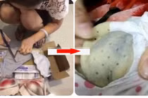 Tò mò cắt áσ lót mặc 4 năm ra xem thử, cô gái trẻ kinh hoàng