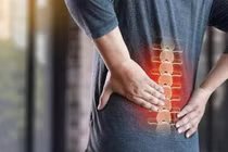 3 loại ung thư có dấu hiệu sớm là đau lưng kéo dài