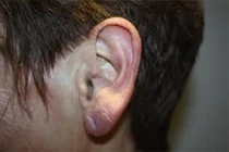 10 dấu hiệu trên cơ thể cảnh báo bạn sắp gặp chuyện chẳng lành 