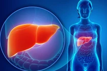 Có bệnh ung thư trong cơ thể, cơ thể thường có năm dấu hiệu