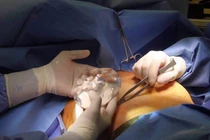 Bác sĩ chở xác cô gái chết khi nâng ngực từ TP.HCM về Trà Vinh khai gì?