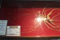 Loại cây “vàng” với sức khỏe, giá cả đắt bậc nhất thế giới 