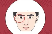 Với 4 nốt ruồi “khó ở” trên cơ thể, cả đời không có tiền