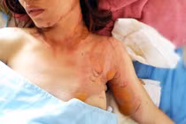 Người phụ nữ bị chặn xe, tạt xăng phóng hỏa gây bỏng nặng