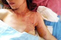 Người phụ nữ bị chặn xe, tạt xăng phóng hỏa gây bỏng nặng