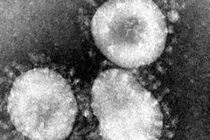 Phát hiện ca nhiễm dịch bệnh COVID-19 đầu tiên tại châu Phi