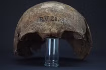 Hộp sọ của người đàn ông 5.000 tuổi hé lộ vết cắn chết chóc 