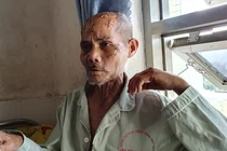 Nghi án giành đất, cha già bị rạch nát đầu: Các bên nói gì?