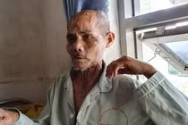 Nghi án giành đất, cha già bị rạch nát đầu: Các bên nói gì?