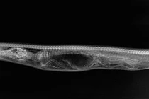 Loạt ảnh X-quang trăn tiêu hóa cá sấu trong bụng gây sốc