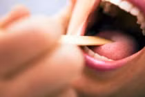 8 điều bất thường xảy ra thường xuyên là tín hiệu ung thư miệng