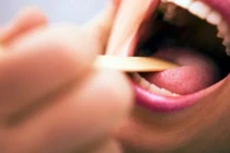 8 điều bất thường xảy ra thường xuyên là tín hiệu ung thư miệng