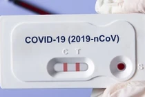 Công nghệ sinh quang học mới phát hiện nhanh COVID-19: Hiệu quả sao? 