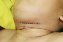 Những vụ chó tấn công người kinh hoàng nhất 2018 ở Việt Nam