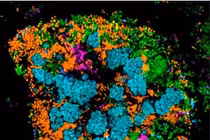 Chùm ảnh đẹp lạ các vi khuẩn sống trên răng bạn