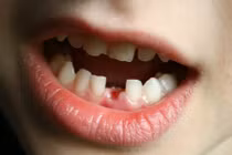 Những sự thật khó tin về bộ răng của con người