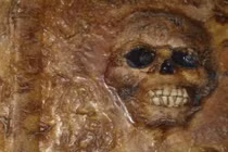 Chuyện rùng rợn cuốn sách y học bọc da người