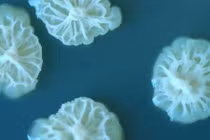 Khám phá sốc về sự phát triển của vi khuẩn trên không gian