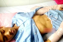 Nghệ An: Mâu thuẫn nhỏ, chém trọng thương cha con hàng xóm