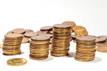 Kỳ lạ cô gái nuốt gần 1,7kg nữ trang vào bụng trong nhiều năm