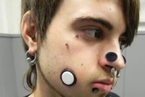 Kinh dị với trào lưu đục lỗ trên mặt để làm đẹp của giới trẻ