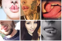 Kinh dị biến chứng khủng khiếp sau trào lưu tách lưỡi của giới trẻ
