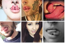 Kinh dị biến chứng khủng khiếp sau trào lưu tách lưỡi của giới trẻ