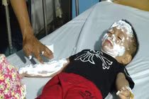 Nổ bóng bay hydro: Thận trọng với những “quả bom” di động 