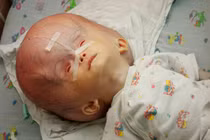 Loạt ảnh kinh hoàng về di chứng của chiến tranh Việt Nam (1)