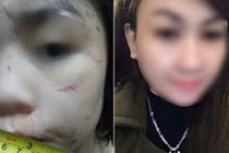 Bé 10 tuổi bị bạo hành: Mẹ kế vẫn lên Facebook khoe bảng điểm của con