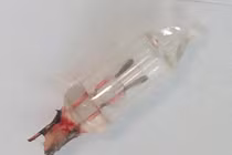 Hy hữu: Bác sĩ phát hiện đèn led trong phổi bé gái 14 tháng