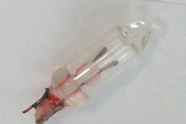 Hy hữu: Bác sĩ phát hiện đèn led trong phổi bé gái 14 tháng