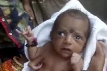 Bé gái chào đời với 3 bàn tay được dân tôn thờ như thần