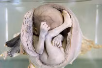 Điều khiếp đảm ở bảo tàng rùng rợn nhất Thái Lan