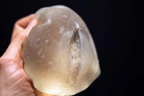 Nổ túi ngực khi đi máy bay, bác sĩ nói có nổ vỡ được không, sự thực bất ngờ