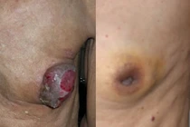 Quái gở quý ông mắc bệnh phổ biến của phụ nữ 