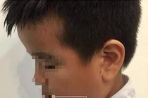 Hải Phòng: Mẹ HS lớp 2 đăng clip cô giáo tát tới tấp, dùng thước vụt mạnh nhiều em