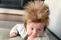 Bé 4 tháng tuổi có mái tóc "tươi tốt lạ kỳ"