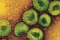 Virus “tử thần” MERS-CoV nguy hiểm như thế nào?