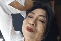 “Thục nữ Thái Lan” đi tân trang da mặt nhưng cái kết sốc