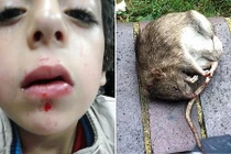 Hãi hùng chuột khổng lồ đói bụng tấn công bé 5 tuổi