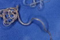 Ghê tởm những loài ký sinh độc ác nhất hành tinh 