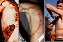 Những vụ cá mập tấn công người gây ác mộng nhất (1)