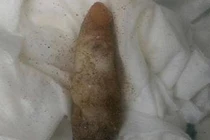 San hô hình... tay người chết gây nhầm lẫn cho cảnh sát